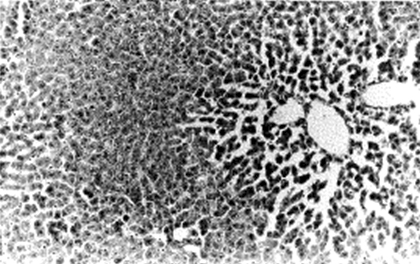 enfermedad_venooclusiva_hepatica/rata_ureato_x10 enfermedad_venooclusiva_hepatica/rata_ureato_x10