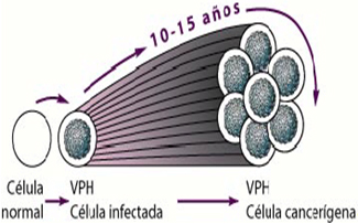 cancer_cervico_uterino/celula_infectada_cancer