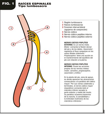 esclerosis_multiple_etiopatogenia/raices_espinales_lumbosacro