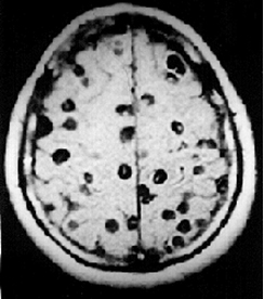 prevalencia_tenia_teniasis/material_sociograma_4