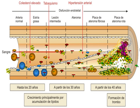 sindrome_coronario_agudo/fisiopatologia_del_SCA sindrome_coronario_agudo/fisiopatologia_del_SCA
