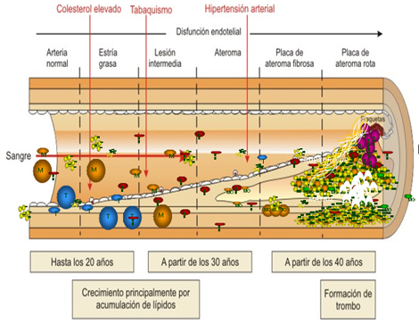 sindrome_coronario_agudo/fisiopatologia_del_SCA