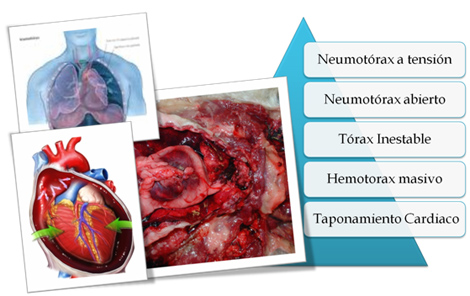 trauma_torax_toracico/condiciones_amenazan_vida