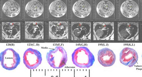 modelo_animal_arteriosclerosis/arteria_coronaria_RMN