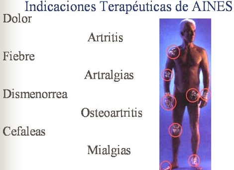 Listado de medicamentos antiinflamatorios no esteroideos