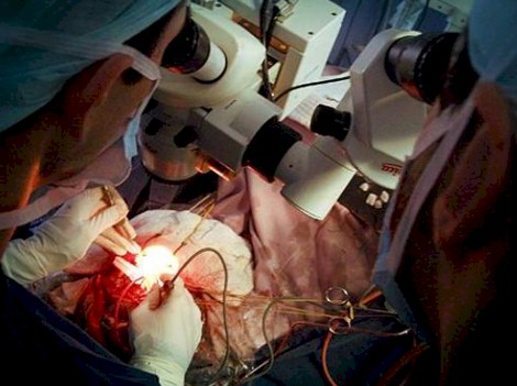 neurocirugia_microcirugia_estereotaxica/cirugia_tumor_cerebral neurocirugia_microcirugia_estereotaxica/cirugia_tumor_cerebral