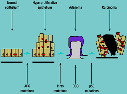 acidos_biliares_heces/secuencia_adenoma_carcinoma