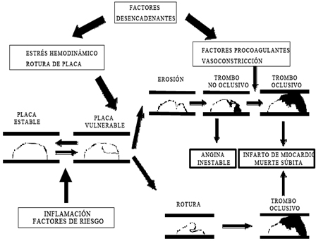 sindrome_coronario_agudo/aspectos_fisiopatologicos_obstruccion sindrome_coronario_agudo/aspectos_fisiopatologicos_obstruccion