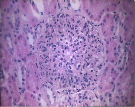 utilidad_biopsia_renal/imagen_renal_3