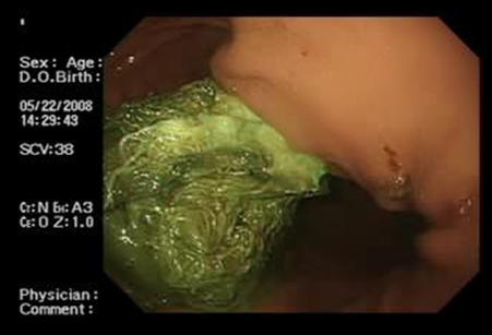 recopilacion_casos_oblitos/Masa_fija_compresoma recopilacion_casos_oblitos/Masa_fija_compresoma