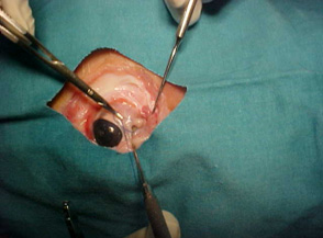 cirugia_experimental_estrabismo/clampeo_oblicuo_ventral cirugia_experimental_estrabismo/clampeo_oblicuo_ventral