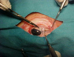 cirugia_experimental_estrabismo/nudo_insercion_tendon