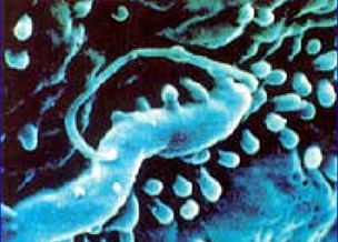 histologia_Helicobacter_pylori/Campilobacterias_helicobacter_microscopia histologia_Helicobacter_pylori/Campilobacterias_helicobacter_microscopia