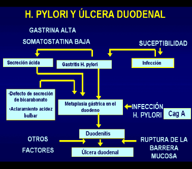 histologia_Helicobacter_pylori/Fisiopatologia_vunculada_ulcera