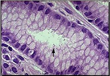 histologia_Helicobacter_pylori/Helicobacter_pylori