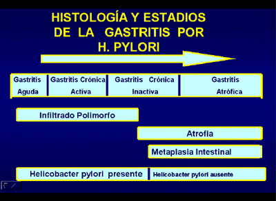 histologia_Helicobacter_pylori/Histologia_estadios_gastritis