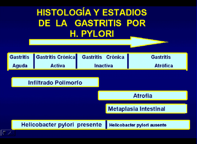 histologia_Helicobacter_pylori/Histologia_estadios_gastritis histologia_Helicobacter_pylori/Histologia_estadios_gastritis