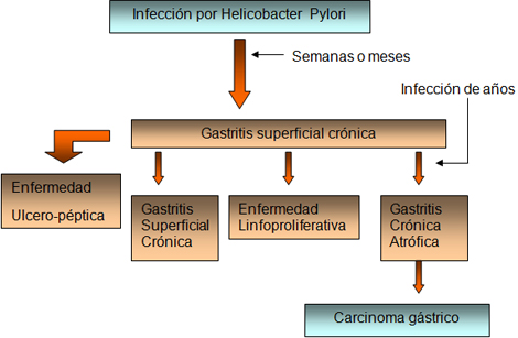 histologia_Helicobacter_pylori/Infeccion_helicobacter_pylori