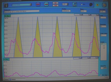 reeducacion_suelo_pelvico/electroterapia_biofeedback_corriente