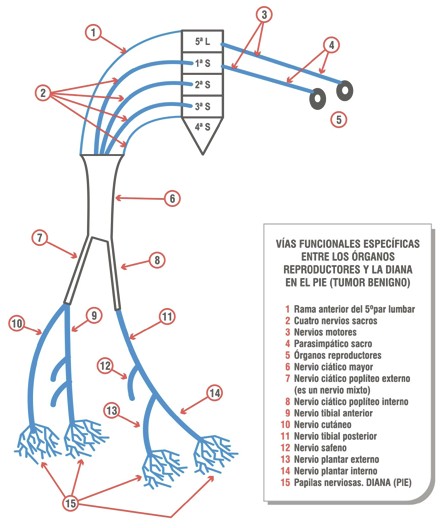 tumores_benignos_malignos/plexo_lumbosacro_tumor tumores_benignos_malignos/plexo_lumbosacro_tumor
