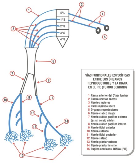 tumores_benignos_malignos/plexo_lumbosacro_tumor