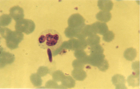 choque_directo_radioactivo/conidia_fungica_opsonizada