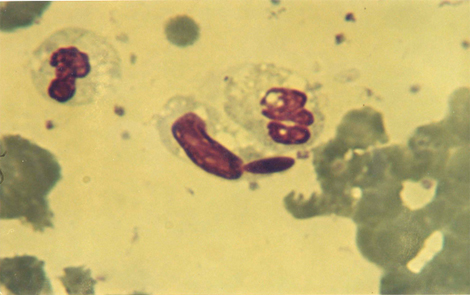 choque_directo_radioactivo/entrada_conidia_neutrofilo