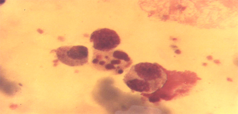 choque_directo_radioactivo/paraforma_inmadurativa_apoptosis choque_directo_radioactivo/paraforma_inmadurativa_apoptosis