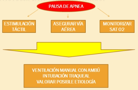 pausas_de_apnea/tratamiento_inicia