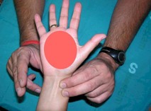 herida_incisa_mano/arteria_radial_cubital herida_incisa_mano/arteria_radial_cubital