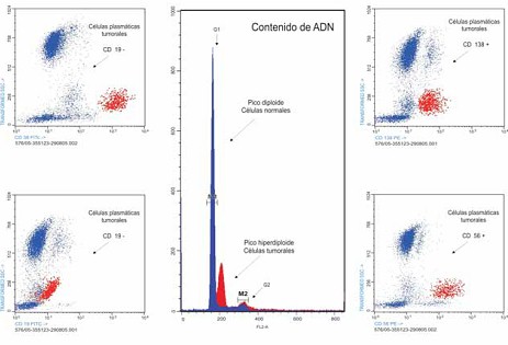 mieloma_multiple_gammapatia/citometria_flujo_compatible