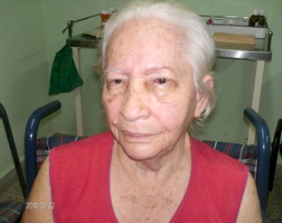 tumor_palpebral_caso/resultados_tratamiento_alta tumor_palpebral_caso/resultados_tratamiento_alta