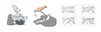 paciente_inconsciente_emergencia/soporte_vital_avanzado paciente_inconsciente_emergencia/soporte_vital_avanzado