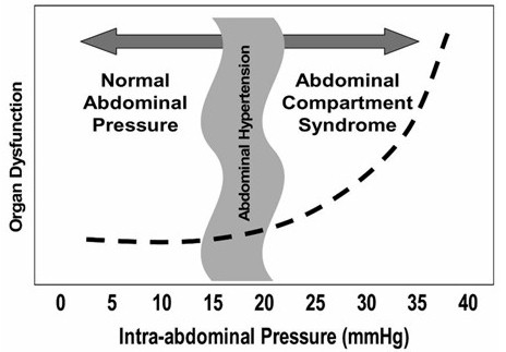 sindrome_compartimental_abdominal/intra-abdominal_hypertension sindrome_compartimental_abdominal/intra-abdominal_hypertension