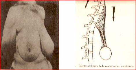 cirugia_plastica_belleza/efecto_mama_columna cirugia_plastica_belleza/efecto_mama_columna