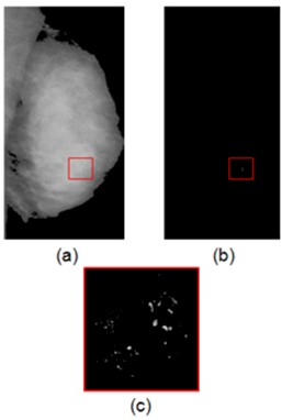 diagnostico_lesiones_mamografia/mamografias_deteccion_microcalcificaciones