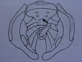dolor_anal_cronico/masaje_digital_ano dolor_anal_cronico/masaje_digital_ano