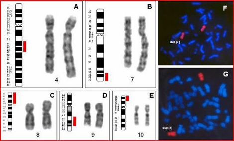 duplicacion_cromosomica_fenotipo/duplicaciones_pacientes
