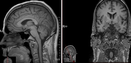 lousy_mind_brain/NMR_RMN_cerebral