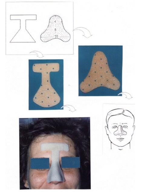 aplicaciones_tecnologia_termoplastica/ejemplo_numero_catorce