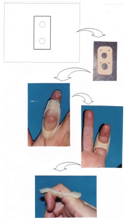 aplicaciones_tecnologia_termoplastica/ejemplo_numero_dos