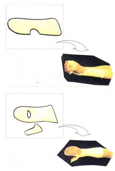 aplicaciones_tecnologia_termoplastica/ejemplo_numero_nueve