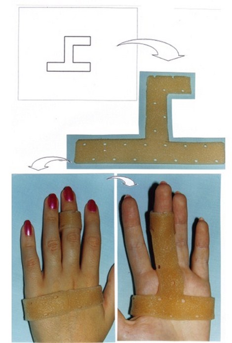 aplicaciones_tecnologia_termoplastica/ejemplo_numero_tres