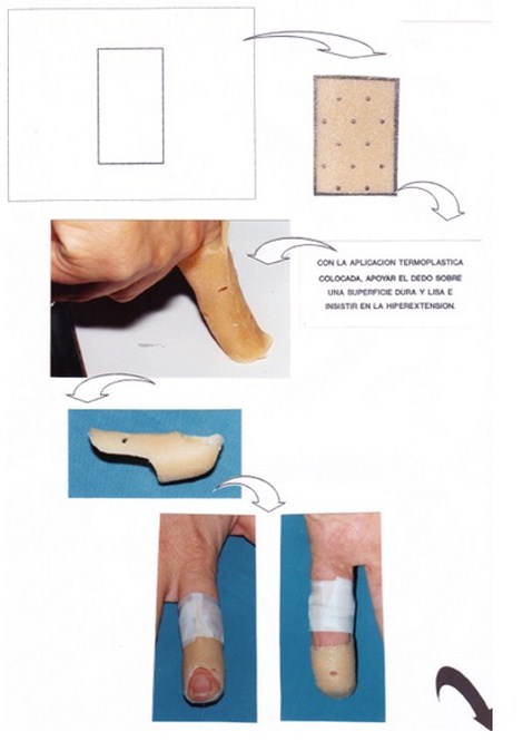 aplicaciones_tecnologia_termoplastica/ejemplo_parte_un