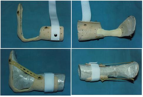 aplicaciones_tecnologia_termoplastica/ferula_antiequino