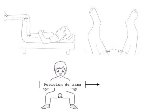 aplicaciones_tecnologia_termoplastica/pelvipedico_posturas_estandar