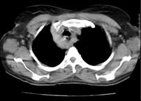 arco_aortico_caso_clinico/figura_2 arco_aortico_caso_clinico/figura_2
