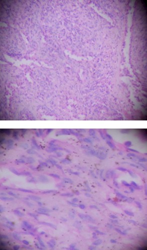 caso_hemangioma_esplenico/microscopio_anatomia_patologica