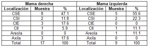 diagnostico_cancer_mama/localizacion_topografica