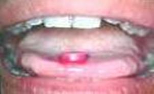 higiene_oral_escolares/eritrosina_pastilla higiene_oral_escolares/eritrosina_pastilla